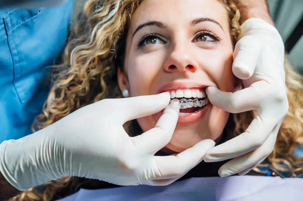 Aligners being placed by an Invisalign orthodontist near you.