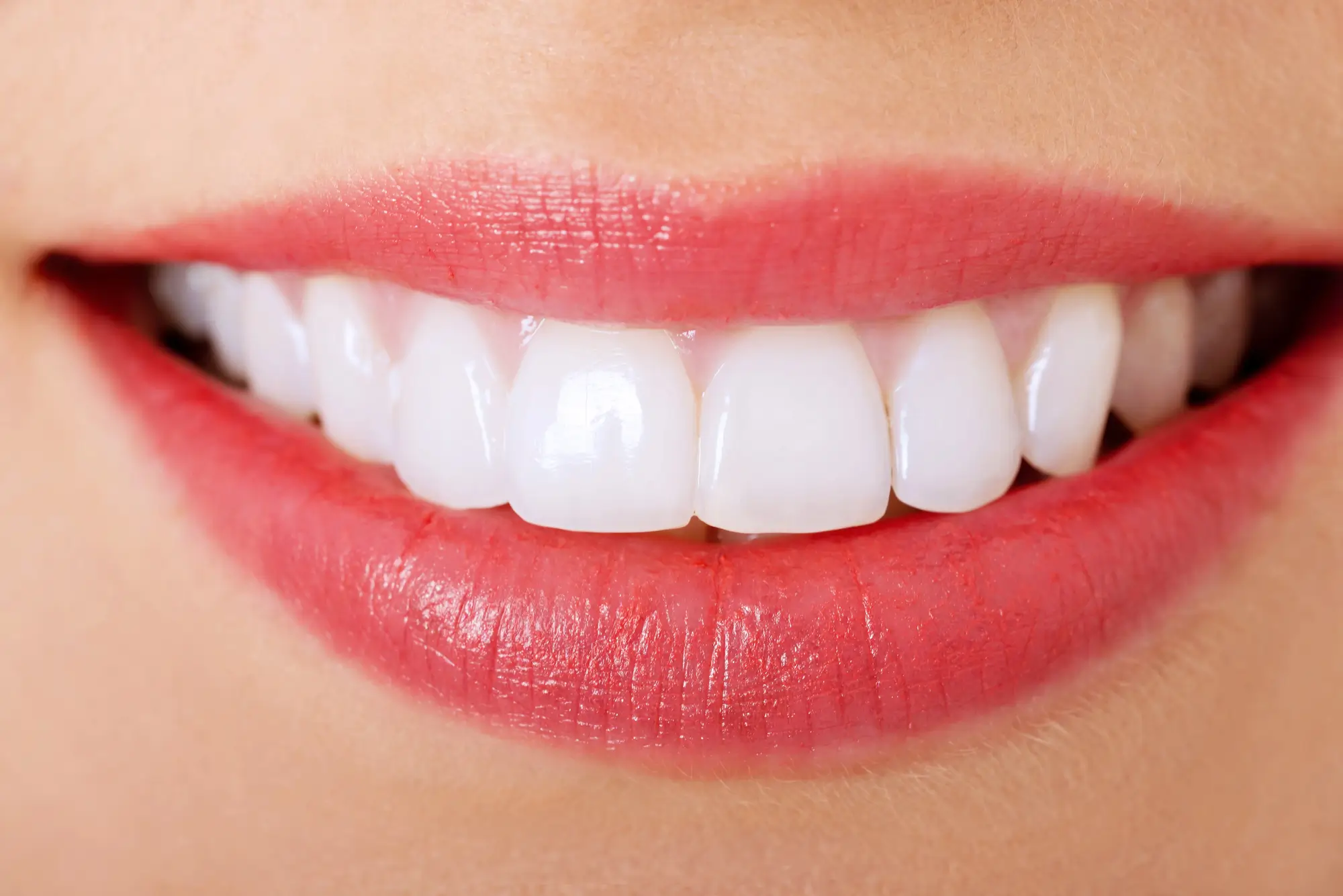 Perfect Smile with Cosmetic Dentistry Panama City FL