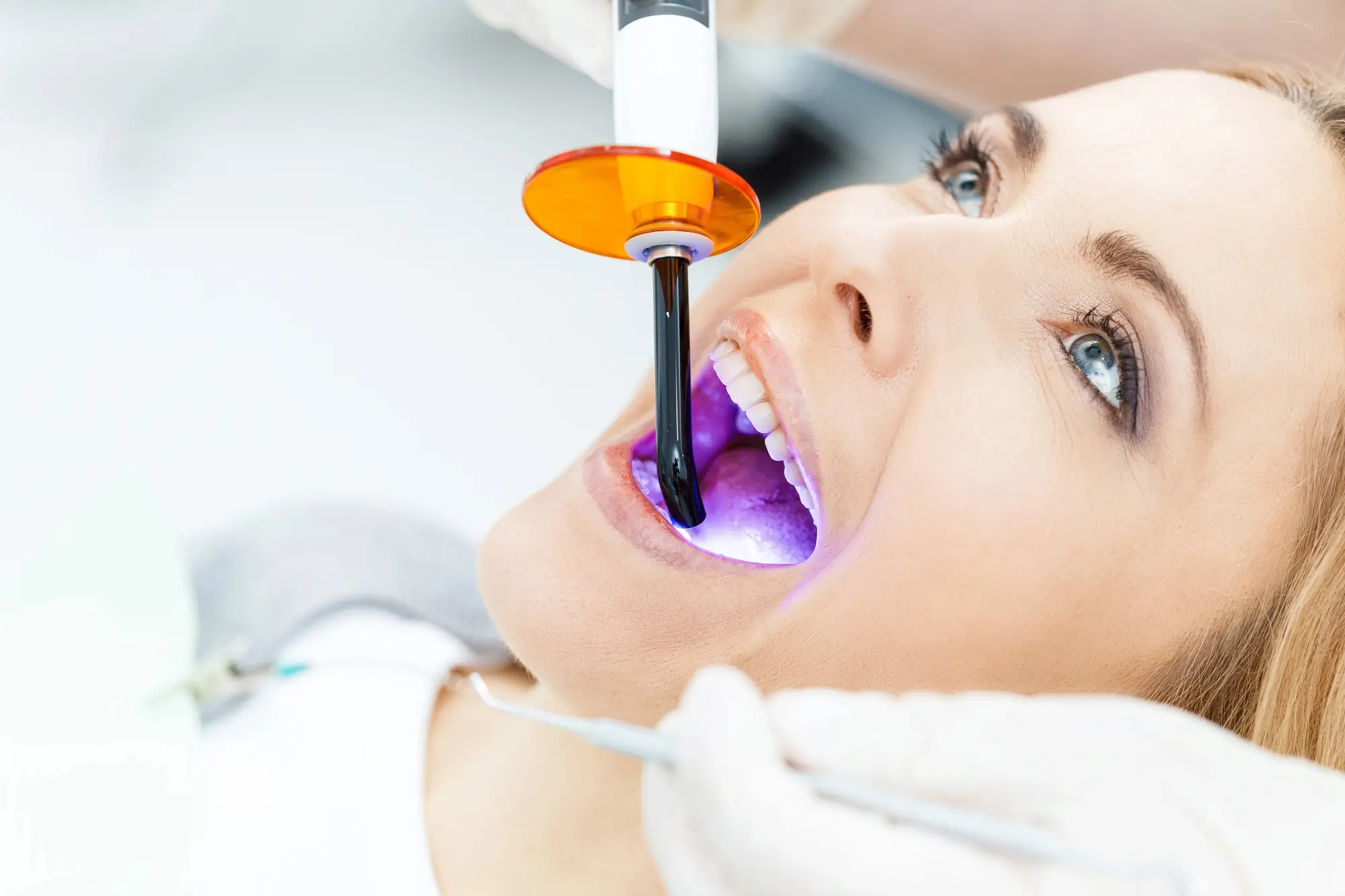 Patient whitening teeth before dental fillings panama city fl