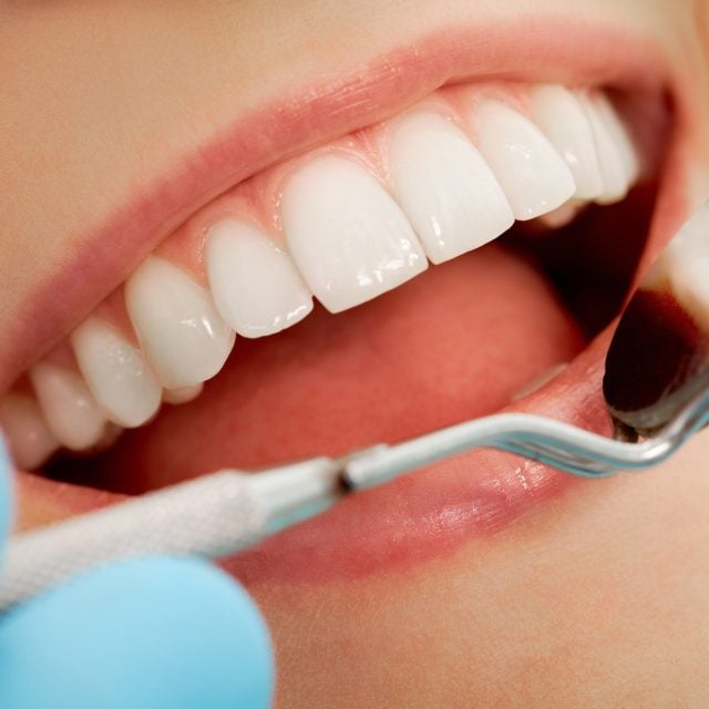 How Improving Your Smile Can Change the Way You Show Up Every Day