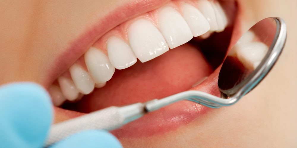 How Improving Your Smile Can Change the Way You Show Up Every Day