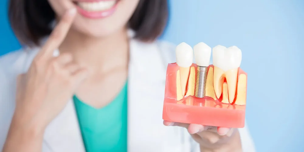 Dental Implants vs. Dental Bridges: Choosing the Right Restoration