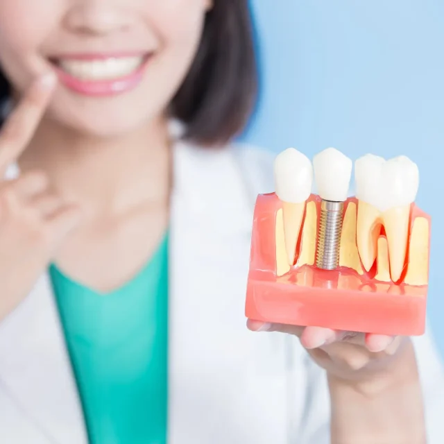Dental Implants vs. Dental Bridges: Choosing the Right Restoration