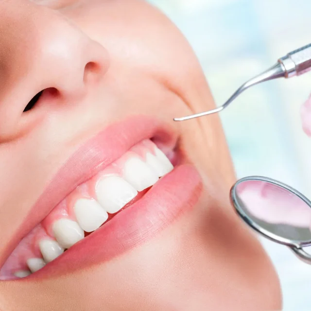 Why Dental Bridges Are a Smart Choice for Missing Teeth 