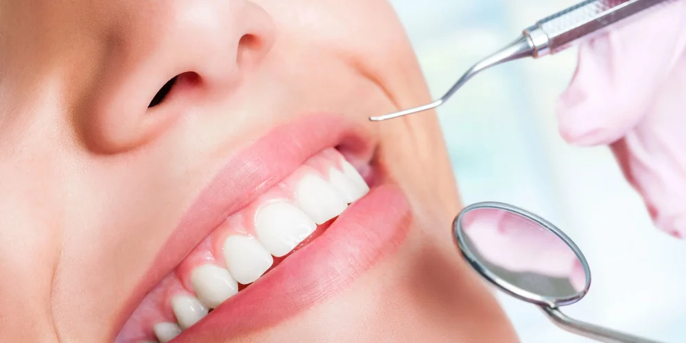 Why Dental Bridges Are a Smart Choice for Missing Teeth 