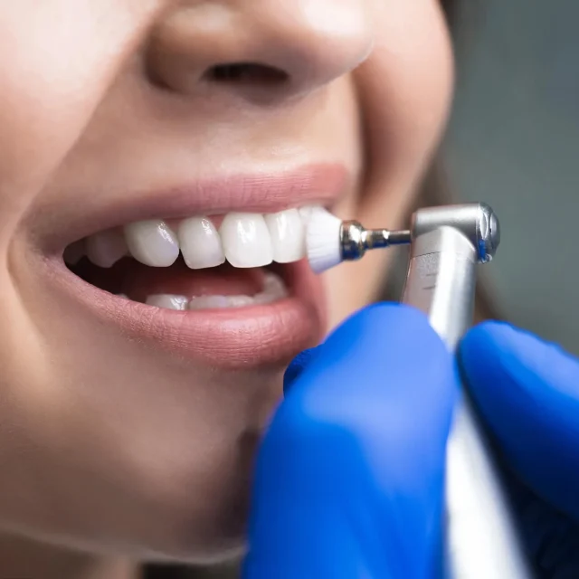 If You Brush and Floss, Do You Still Need a Professional Cleaning? 