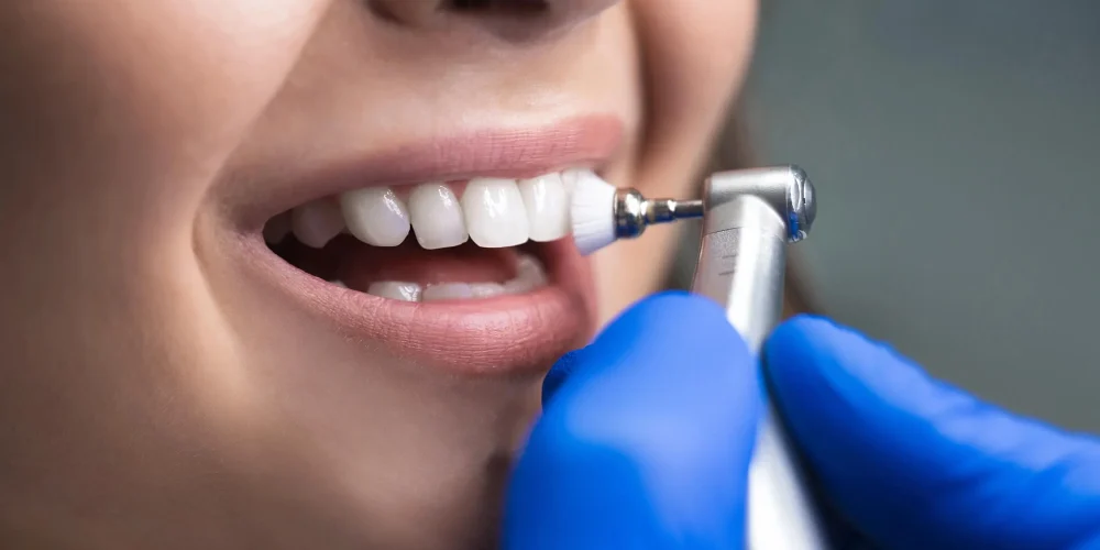 If You Brush and Floss, Do You Still Need a Professional Cleaning? 
