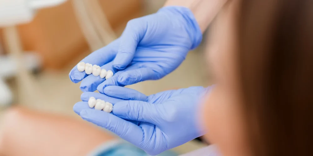 Dental Crowns After a Root Canal: Why They’re So Important